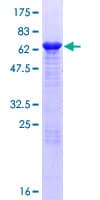 Human AAGAB Protein (Recombinant GST)