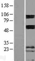 Human TMEM123 / Porimin Protein (Over-Expression Lysate Myc-DDK (Flag))