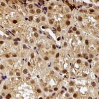 E6AP / UBE3A Antibody