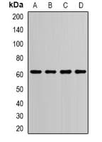 PDI / P4HB Antibody