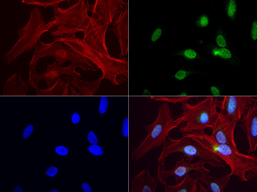PBX1 Antibody (clone UMAB110)