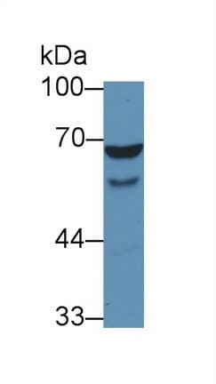 WAS / WASP Antibody (aa39-251)