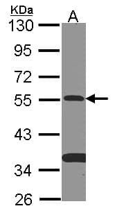 Polyclonal Rabbit anti-Human SMAD9 Antibody (aa166-430, WB)