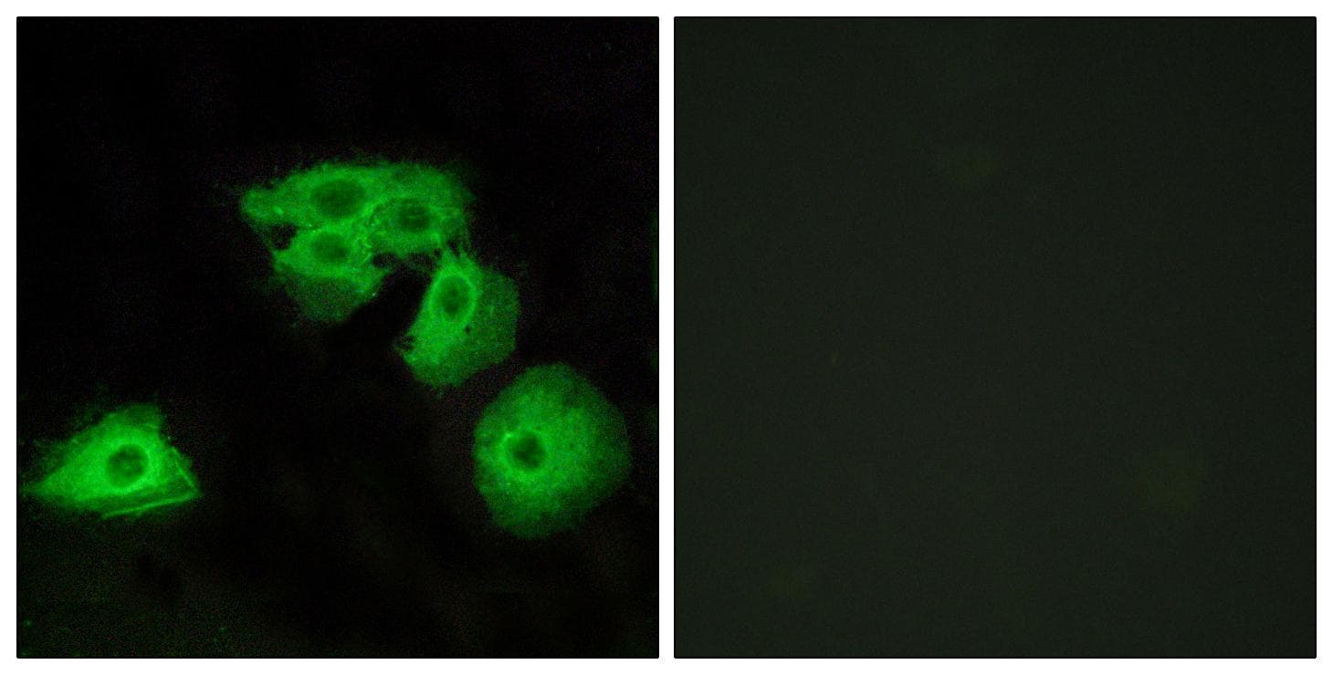 ADORA3 / Adenosine A3 Receptor Antibody