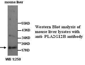 PLA2G12B Antibody (N-Terminus)