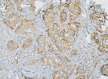 IQGAP1 Antibody