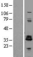 Human Proenkephalin / PENK Protein (Over-Expression Lysate Myc-DDK (Flag))