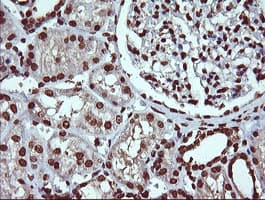 DNM1L / DRP1 Antibody (clone OTI2E7)