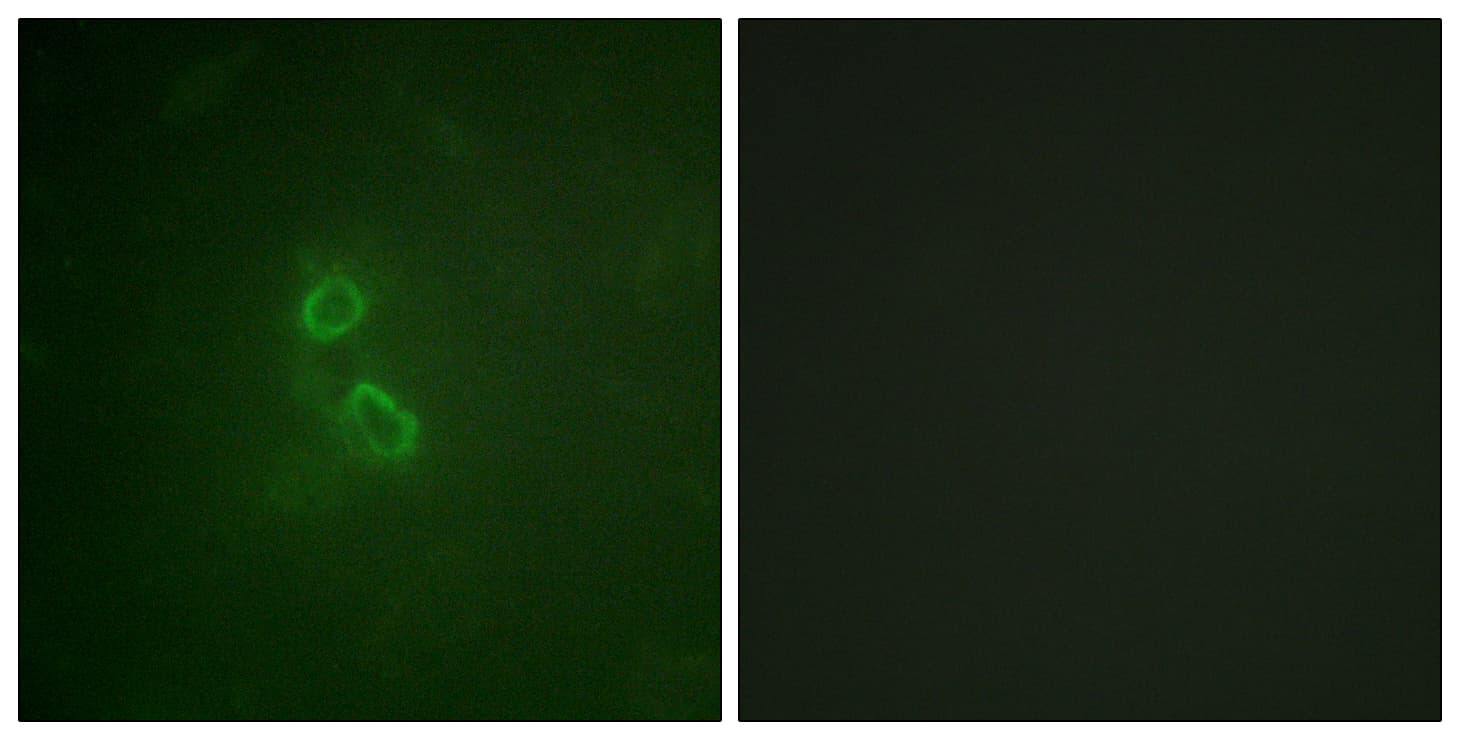 EMA / MUC1 Antibody (aa1201-1250)