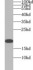 BIRC5 / Survivin Antibody