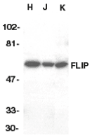 Polyclonal Rabbit anti-Human CFLAR / FLIP Antibody (WB)