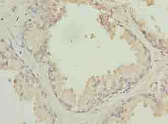HACD2 / PTPLB Antibody