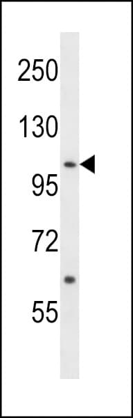 Polyclonal Rabbit anti-Human TNK2 / ACK1 Antibody (aa265-290, WB)