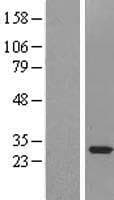 SNRPA1 Protein (Over-Expression Lysate Myc-DDK (Flag))