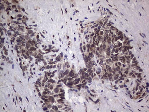 GLI2 Antibody (aa729-1123, clone OTI1G1)