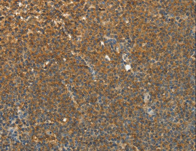 TEKT1 Antibody
