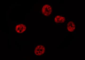 STAT3 Antibody (phospho-Ser727)