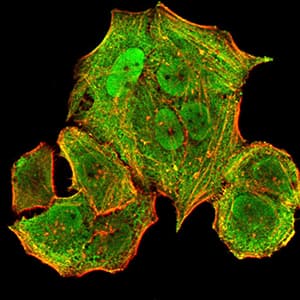 Monoclonal Mouse anti-Human HLA-B Antibody (clone 2G7B10, IHC, IF, WB)