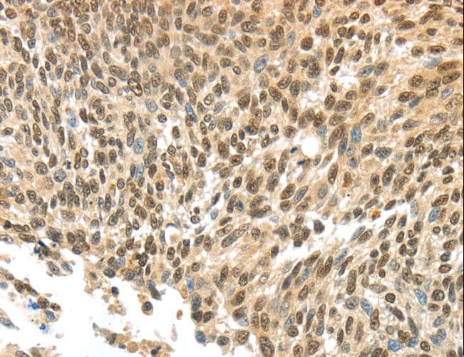 APOL6 / Apolipoprotein L 6 Antibody
