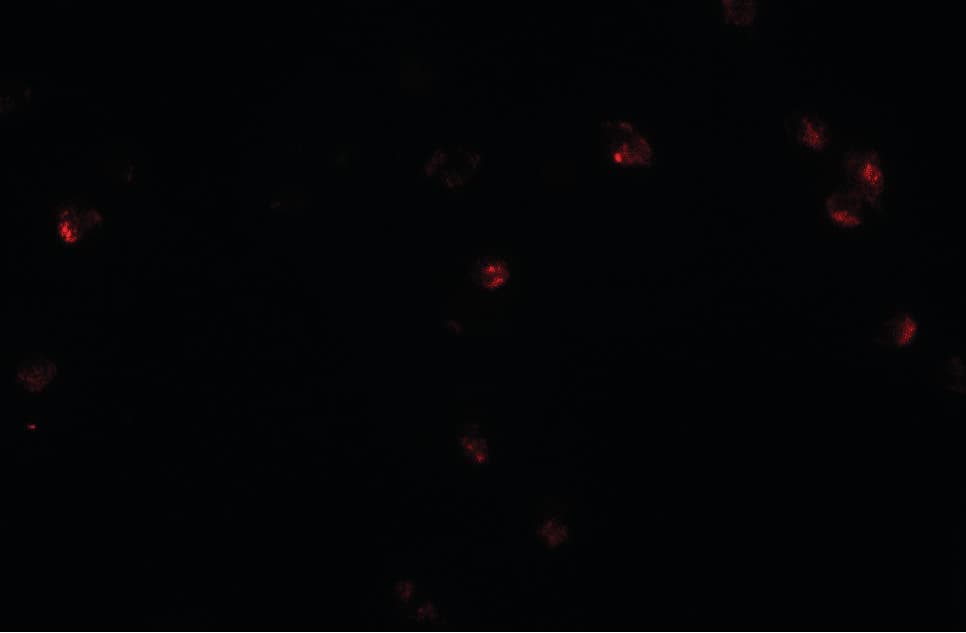 IHC-plus™ Polyclonal Rabbit anti-Human CRIM1 Antibody (IHC, IF, WB)