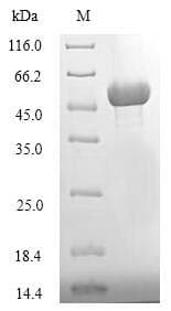 Candida glabrata ATG1 Protein (Recombinant 6His-SUMO, N-terminus)