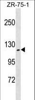 ZHX2 / RAF Antibody (aa105-131)