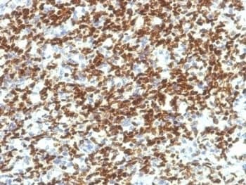 PAX7 Antibody (aa300-600, clone PAX7/1187)