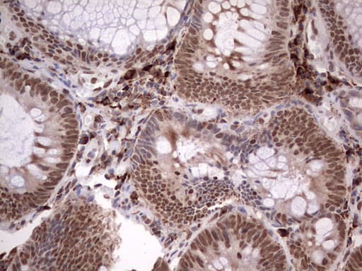 Monoclonal Mouse anti-Human TFPI2 Antibody (clone OTI1G3, Carrier-free, aa23-235, IHC, WB)