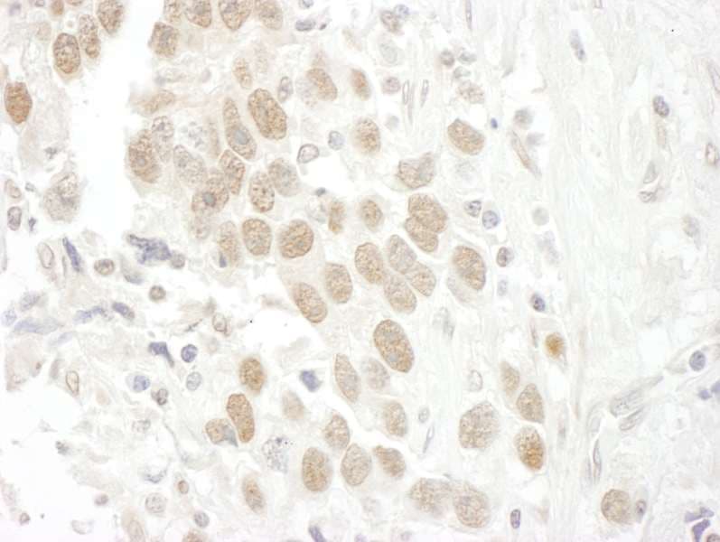 Polyclonal Rabbit anti-Human BCCIP Antibody (aa300-350, IHC, IF)