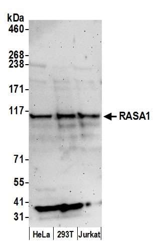 RASA1 Antibody (aa997-1047)