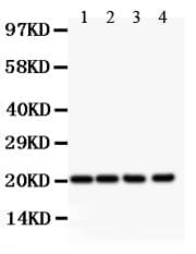 Polyclonal Rabbit anti-Human DHFR Antibody (aa2-187, IHC, WB)