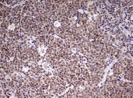 Monoclonal Mouse anti-Human CDCA7L Antibody (clone OTI1A12, aa1-337, IHC, WB)