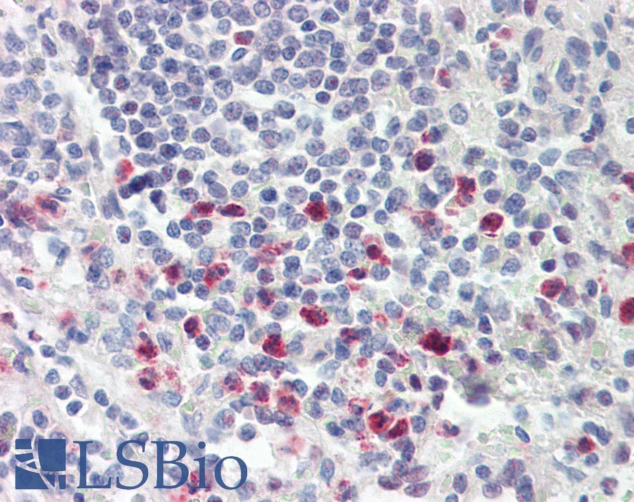 IHC-plus™ MAST3 Antibody (aa1031-1080)