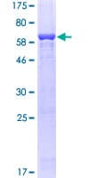 Human AKR1B1 / Aldose Reductase Protein (Recombinant GST)