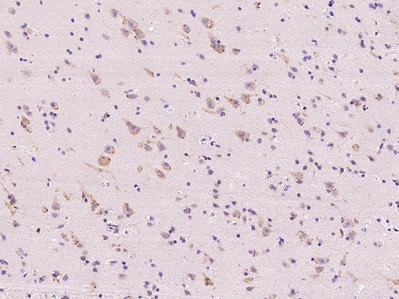 PARK2 / Parkin 2 Antibody