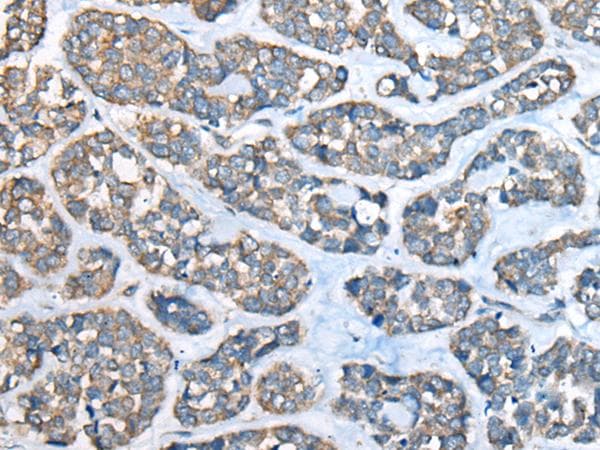 Polyclonal Rabbit anti-Human CED6 / GULP1 Antibody (IHC)