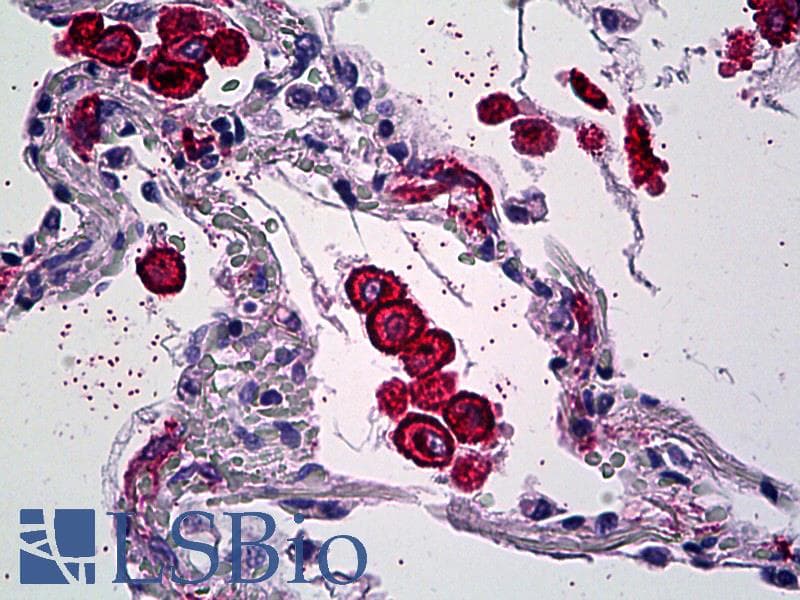 IHC-plus™ Mannose Receptor / CD206 Antibody (clone 5C11)
