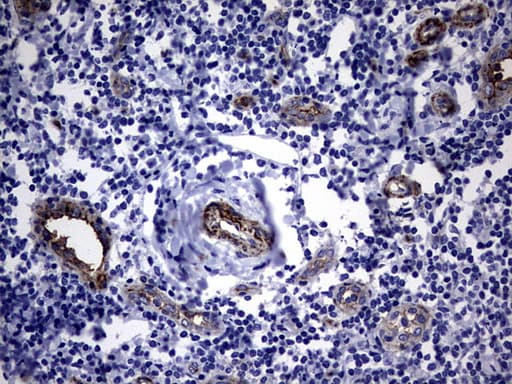 MCAM / CD146 Antibody (clone OTI5C4)