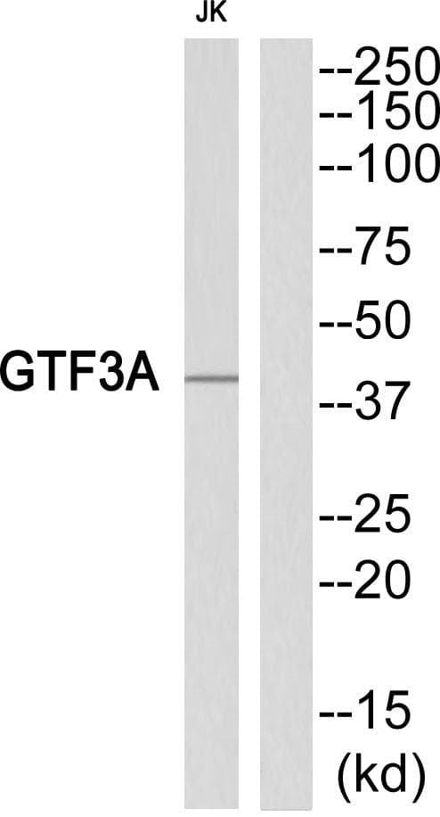 GTF3A Antibody