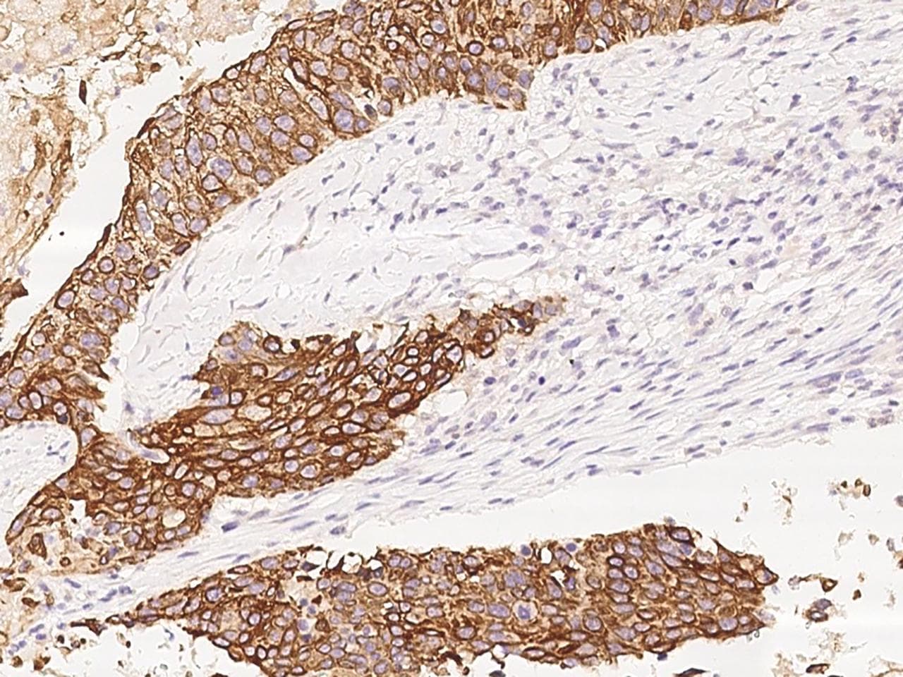FOLR1 / Folate Receptor Alpha Antibody (Preservative Free)