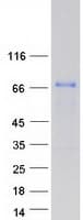 Human CEP72 Protein (Recombinant Myc-DDK (Flag))