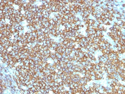 Recombinant Monoclonal Mouse anti-Human CD20 Antibody (clone rIGEL/773, Azide-free,Carrier-free, IHC, IF)