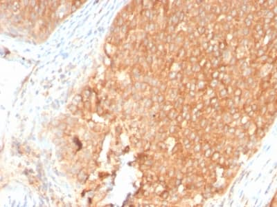 TOP1MT Antibody (clone TOP1MT/2883R)