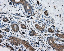 PRKAR2A Antibody (clone OTI4A3)