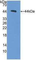 Procalcitonin Antibody (aa26-136)