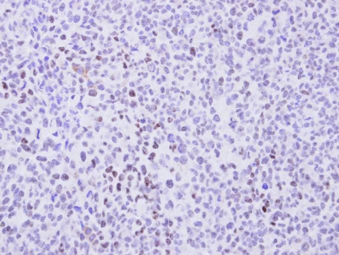 Polyclonal Rabbit anti-Human CCNT2 / Cyclin T2 Antibody (aa497-730, IHC, WB)