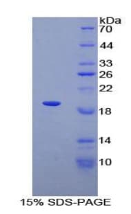 Human ADRA1A Protein (Recombinant His-T7)