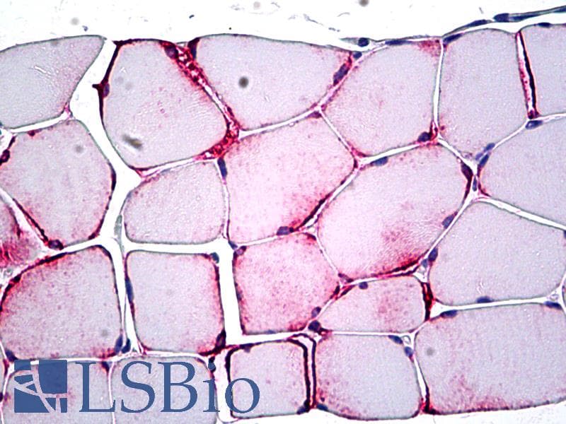 IHC-plus™ Polyclonal Rabbit anti-Human PPP1R13L / iASPP Antibody (aa75-125, IHC, WB)