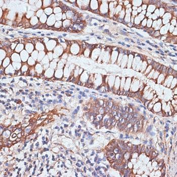 PIGR Antibody