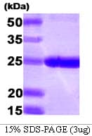 Human PSMB1 Protein (Recombinant His)